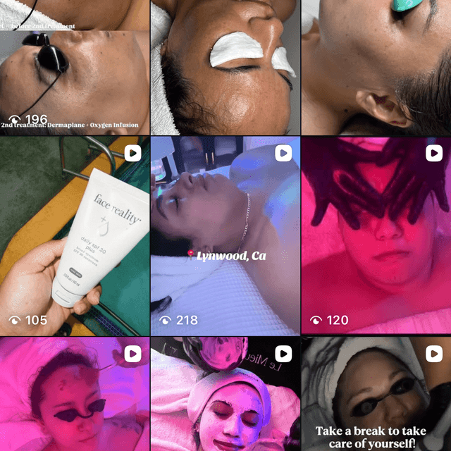 GLOW CLUB at navajskin aesthetics in Lynwood, CA